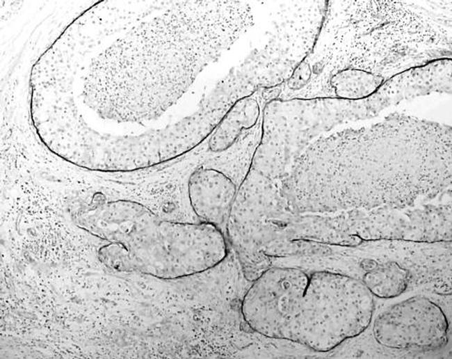 Thrombospondin 1 Antibody in Immunohistochemistry (IHC)