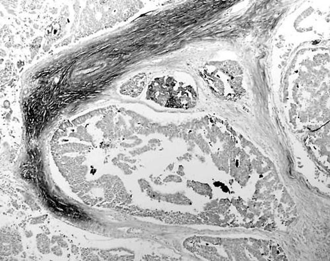 Thrombospondin 1 Antibody in Immunohistochemistry (IHC)