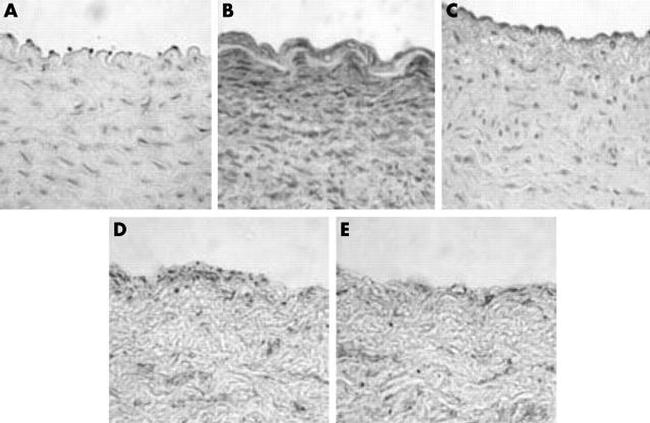 PAR2 Antibody in Immunohistochemistry (IHC)