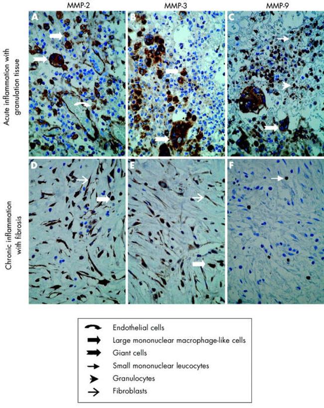 MMP2 Antibody in Immunohistochemistry (IHC)