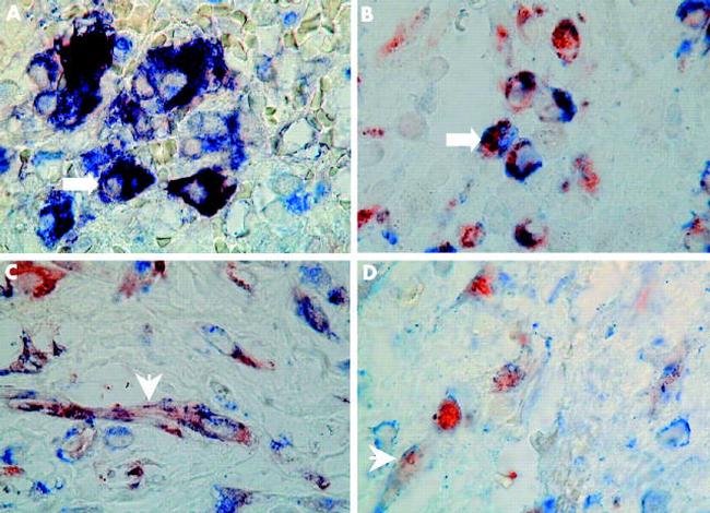 MMP2 Antibody in Immunohistochemistry (IHC)