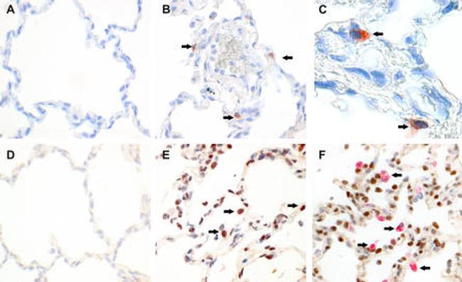 Phospho-STAT1 (Tyr701) Antibody in Immunohistochemistry (IHC)