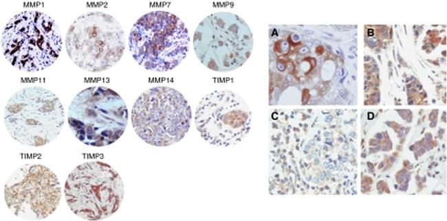 TIMP1 Antibody in Immunohistochemistry (IHC)