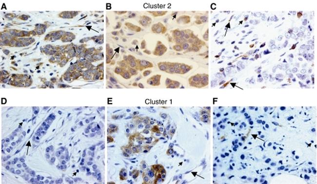 TIMP1 Antibody in Immunohistochemistry (IHC)