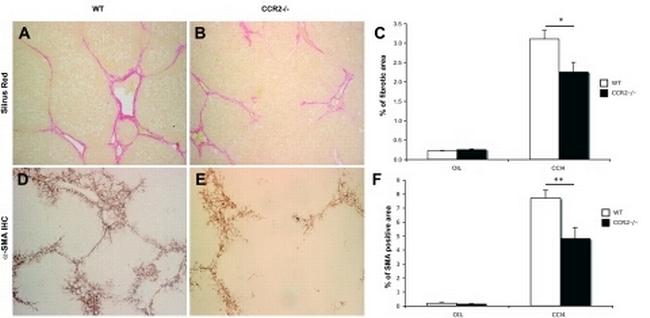 F4/80 Antibody in Immunohistochemistry (IHC)