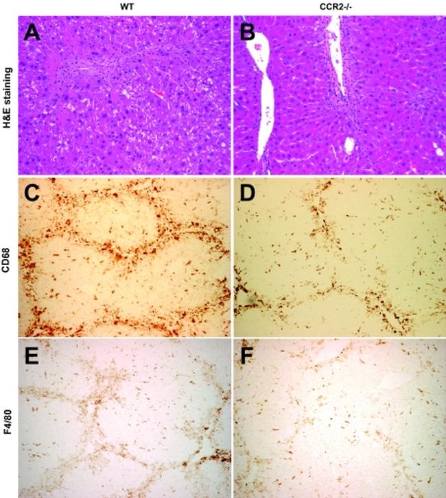 F4/80 Antibody in Immunohistochemistry (IHC)