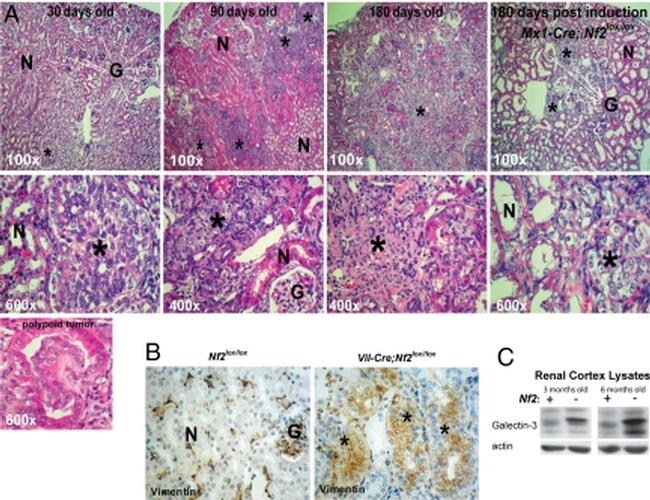 Vimentin Antibody in Immunohistochemistry (IHC)