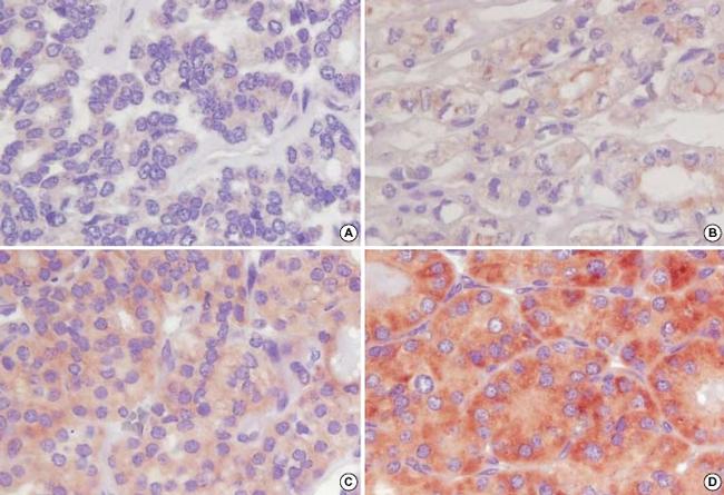 COX2 Antibody in Immunohistochemistry, Immunohistochemistry (Paraffin) (IHC, IHC (P))