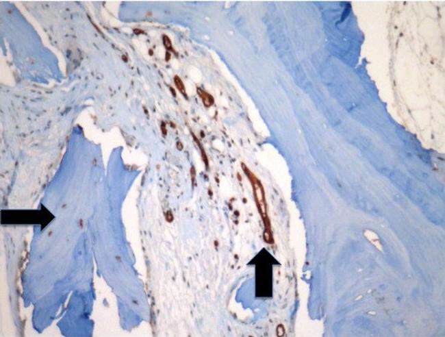 CD34 Antibody in Immunohistochemistry (IHC)