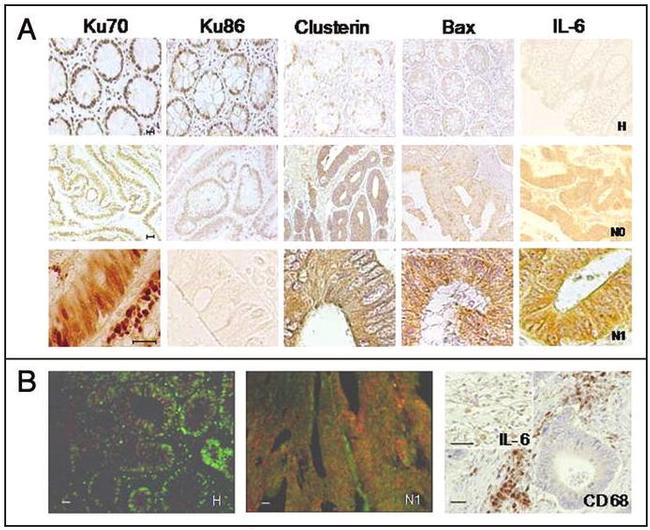 Bax Antibody in Immunohistochemistry (IHC)