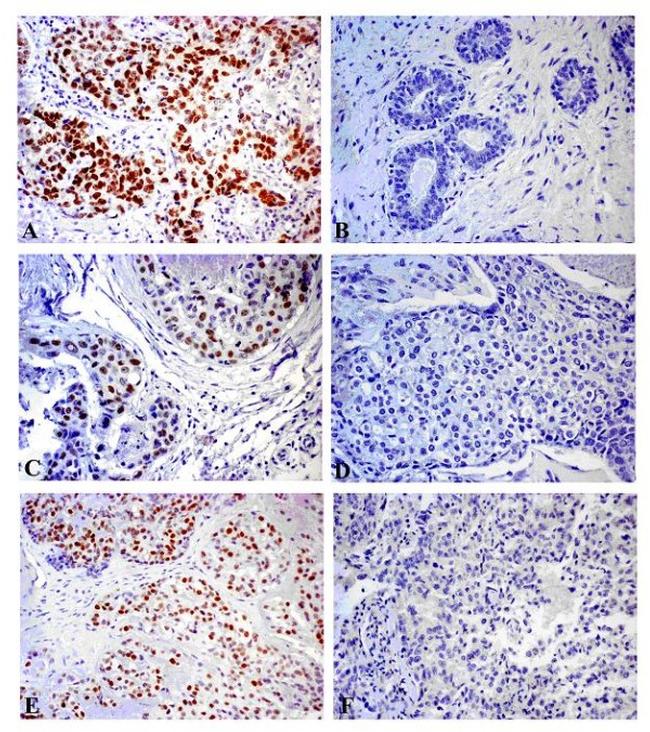 p53 Antibody in Immunohistochemistry (IHC)