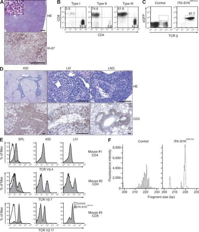 CD3e Antibody in Immunohistochemistry (Paraffin) (IHC (P))