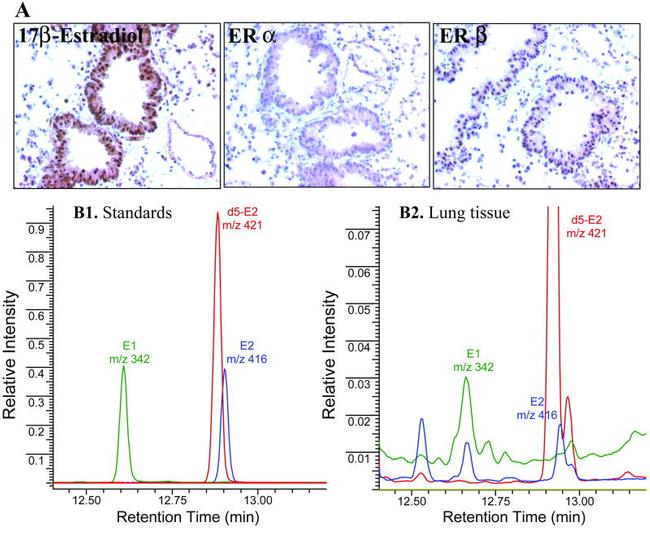 Estrogen Receptor beta Antibody in Immunohistochemistry (IHC)