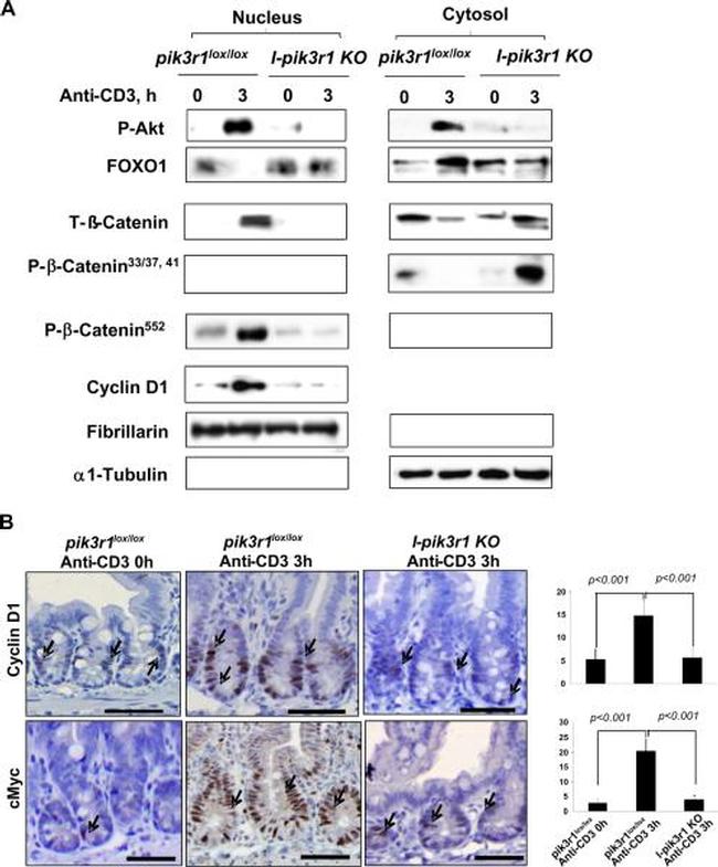 Cyclin D1 Antibody in Immunohistochemistry (IHC)