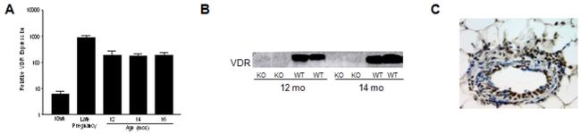 VDR Antibody in Immunohistochemistry (IHC)