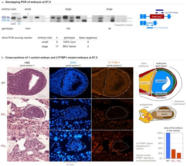 PTBP1 Antibody in Immunohistochemistry (IHC)