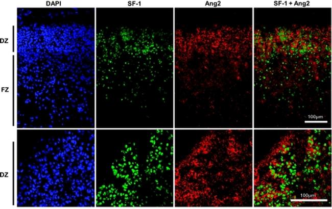 NR5A1 Antibody in Immunohistochemistry (IHC)