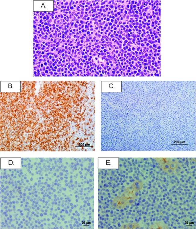 CD3 Antibody in Immunohistochemistry (IHC)