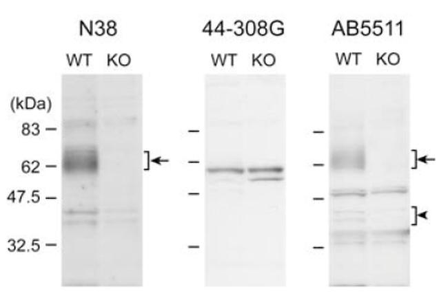 OPRM1 Antibody in Western Blot (WB)