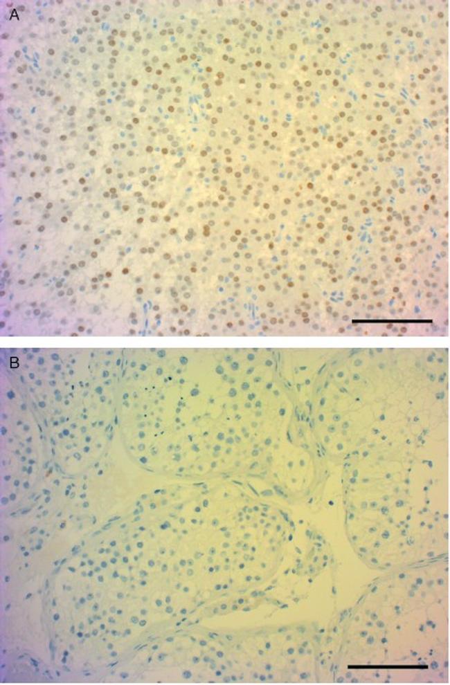 NR5A1 Antibody in Immunohistochemistry (IHC)