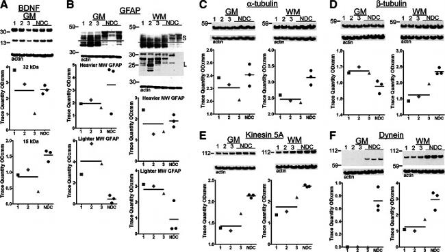 Kinesin 5A Antibody in Western Blot (WB)