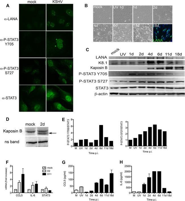 CCL5 (RANTES) Antibody in ELISA (ELISA)