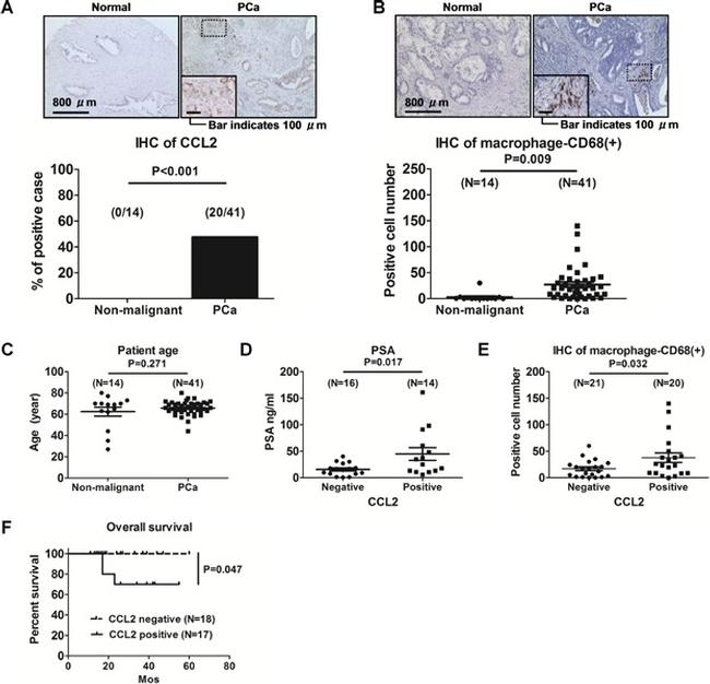 CD68 Antibody in Immunohistochemistry, Immunohistochemistry (Paraffin) (IHC, IHC (P))