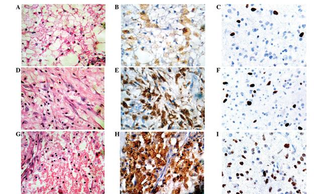 PODXL Antibody in Immunohistochemistry (IHC)