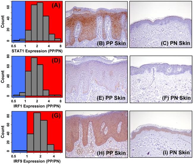 IRF9 Antibody in Immunohistochemistry (Paraffin) (IHC (P))