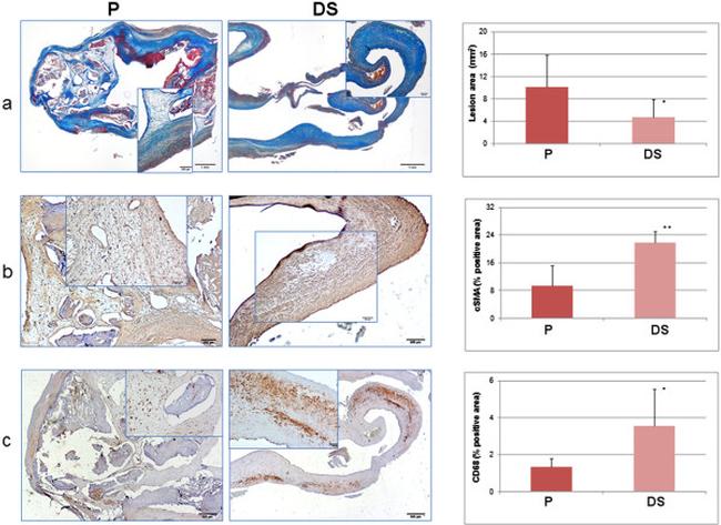 CD68 Antibody in Immunohistochemistry (IHC)