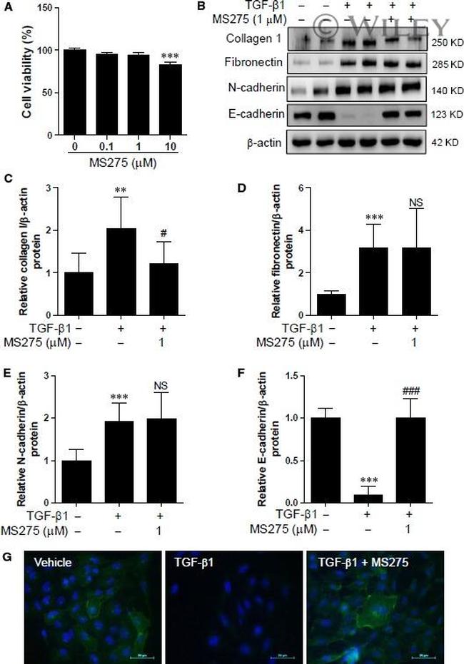 Fibronectin Antibody in Western Blot (WB)