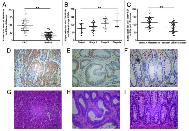 TMPRSS4 Antibody in Immunohistochemistry (IHC)