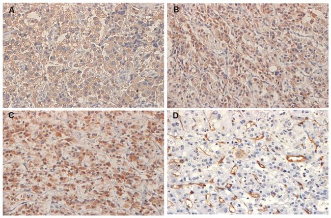 VEGF Receptor 1 (soluble) Antibody in Immunohistochemistry, Immunohistochemistry (Paraffin) (IHC, IHC (P))