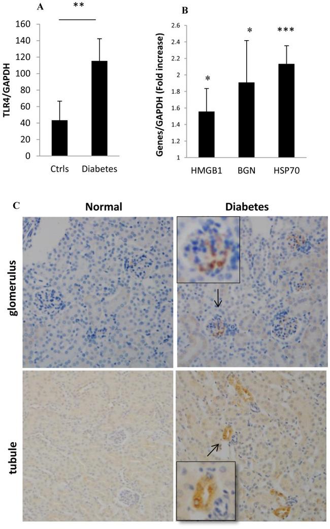 TLR4 Antibody in Immunohistochemistry, Immunohistochemistry (Paraffin) (IHC, IHC (P))