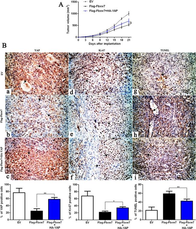 YAP1 Antibody in Immunohistochemistry (IHC)