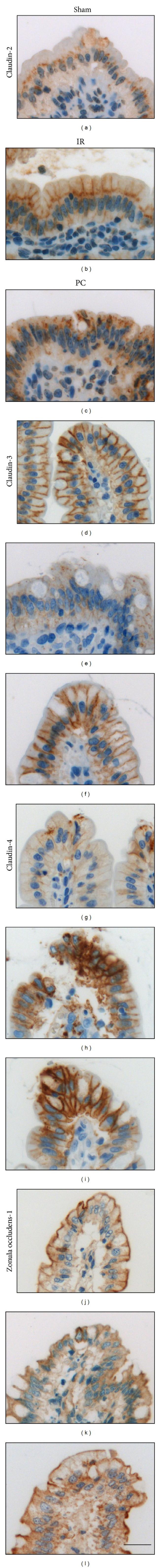 Claudin 3 Antibody in Immunohistochemistry, Immunohistochemistry (Paraffin) (IHC, IHC (P))