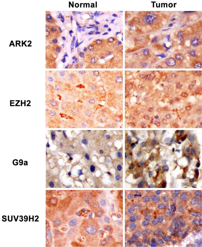 EZH2 Antibody in Immunohistochemistry, Immunohistochemistry (Paraffin) (IHC, IHC (P))