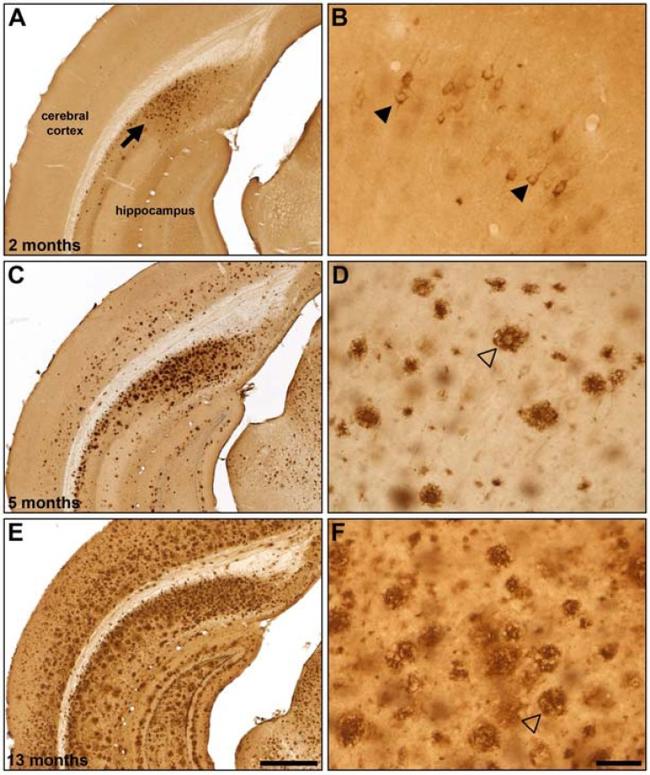 beta Amyloid Antibody in Immunohistochemistry, Immunohistochemistry (Frozen) (IHC, IHC (F))