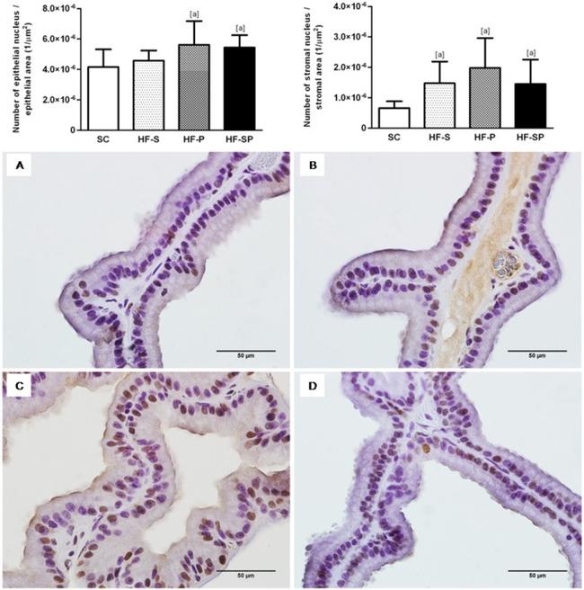 PCNA Antibody in Immunohistochemistry, Immunohistochemistry (Paraffin) (IHC, IHC (P))