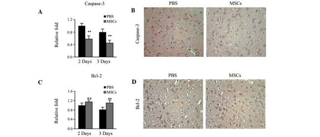 Caspase 3 Antibody in Immunohistochemistry (IHC)