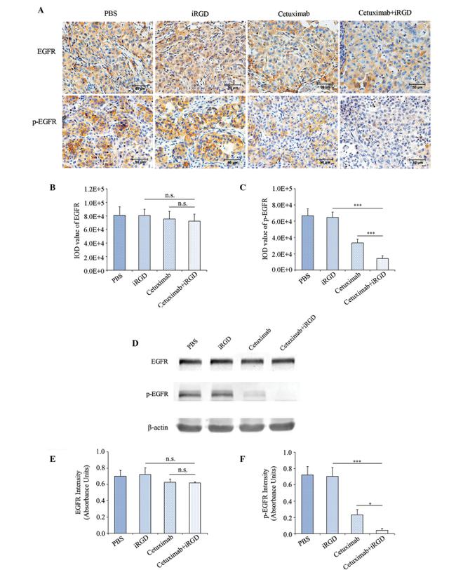 Phospho-EGFR (Tyr1086) Antibody in Western Blot, Immunohistochemistry, Immunohistochemistry (Paraffin) (WB, IHC, IHC (P))