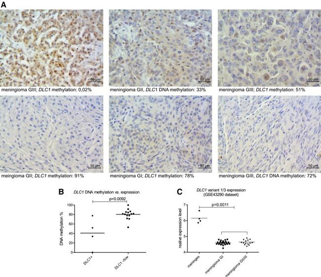 DLC1 Antibody in Immunohistochemistry, Immunohistochemistry (Paraffin) (IHC, IHC (P))