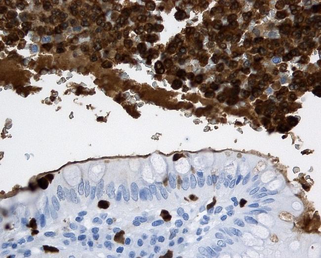 Calprotectin Antibody in Immunohistochemistry, Immunohistochemistry (Paraffin) (IHC, IHC (P))