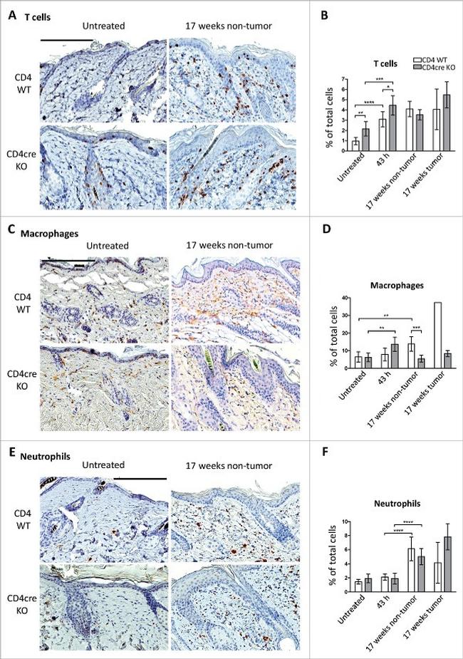 F4/80 Antibody in Immunohistochemistry, Immunohistochemistry (Paraffin) (IHC, IHC (P))