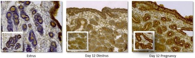 HK2 Antibody in Immunohistochemistry, Immunohistochemistry (Paraffin) (IHC, IHC (P))