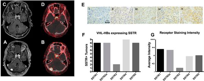 SSTR2 Antibody in Immunohistochemistry, Immunohistochemistry (Paraffin) (IHC, IHC (P))