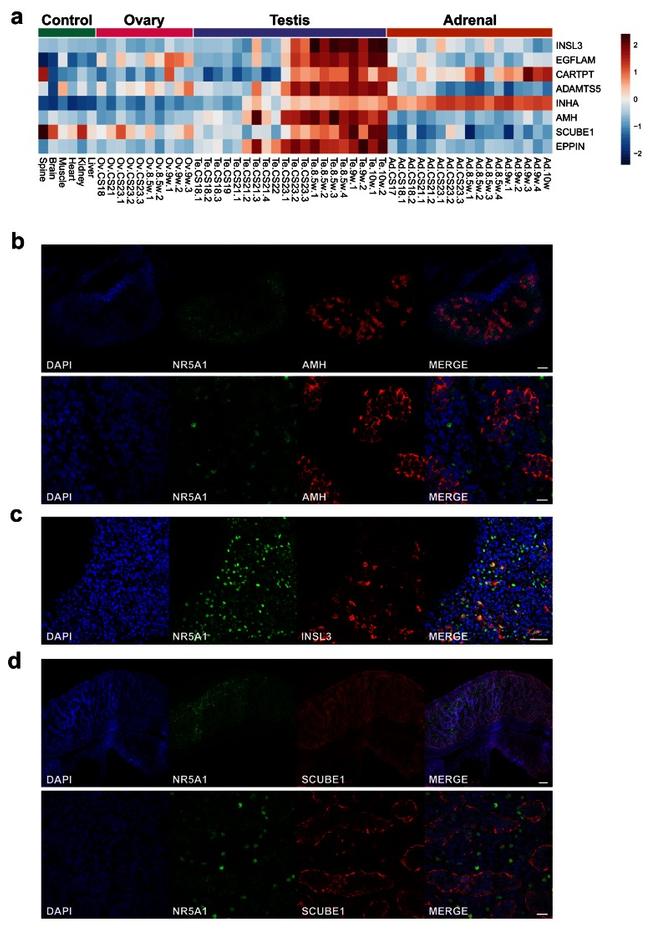 NR5A1 Antibody in Immunohistochemistry (IHC)