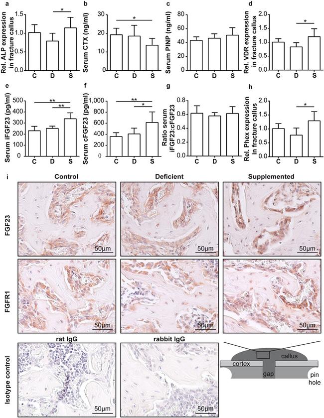 FGFR1 Antibody in Immunohistochemistry (IHC)