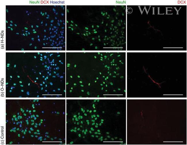 Doublecortin Antibody in Immunocytochemistry (ICC/IF)