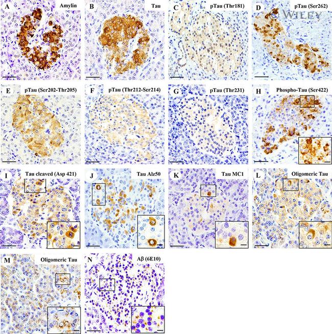 Phospho-Tau (Ser262) Antibody in Immunohistochemistry (IHC)